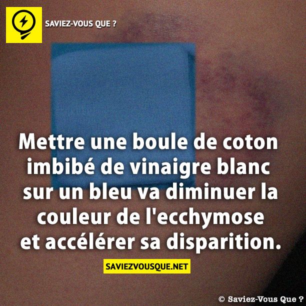Mettre une boule de coton imbibé de vinaigre blanc sur un bleu va diminuer la couleur de l'ecchymose et accélérer sa disparition.