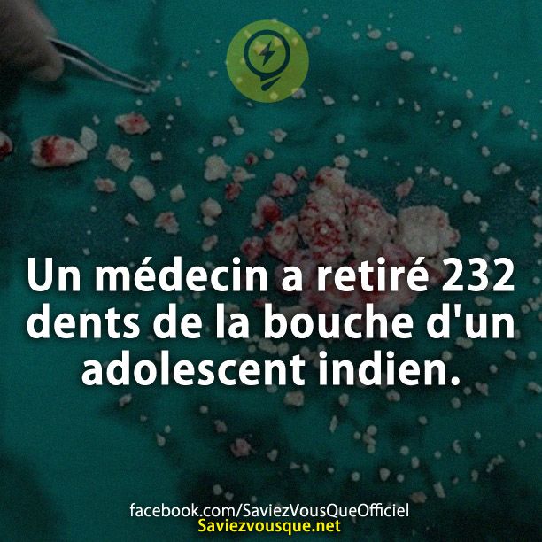 Un médecin a retiré 232 dents de la bouche d&#039;un adolescent indien.
