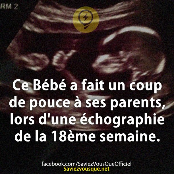 Ce Bébé a fait un coup de pouce à ses parents, lors d&#039;une échographie de la 18ème semaine.