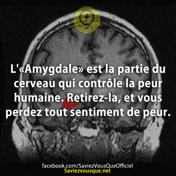 L&#039;«Amygdale» est la partie du cerveau qui contrôle la peur humaine. Retirez-la, et vous perdez tout sentiment de peur.