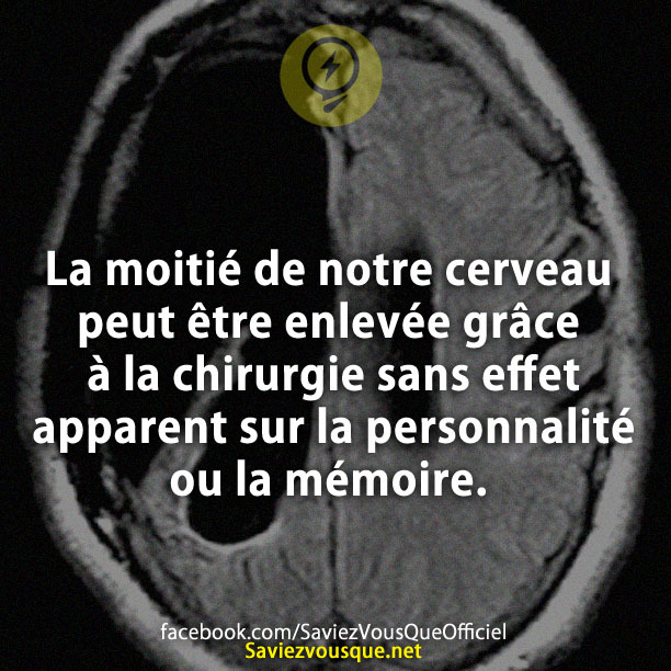 La moitié de notre cerveau peut être enlevée grâce à la chirurgie sans effet apparent sur la personnalité ou la mémoire.