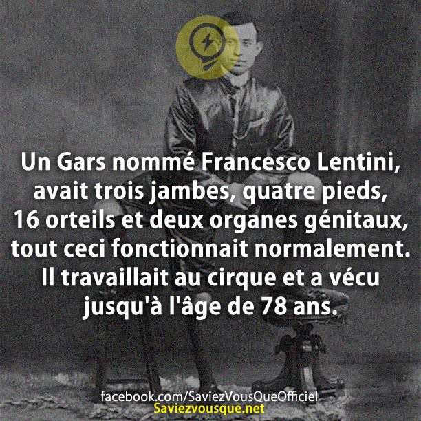 Un Gars nommé Francesco Lentini &quot;avait trois jambes, quatre pieds, 16 orteils et deux organes génitaux, tout ceci fonctionnait normalement. Il travaillait au cirque et a vécu jusqu&#039;à l&#039;âge de 78 ans.