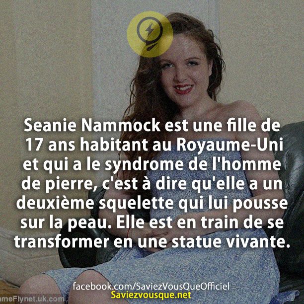 Seanie Nammock est une fille de 17 ans habitant au Royaume-Uni et qui a le syndrome de l&#039;homme de pierre, c&#039;est à dire qu&#039;elle a un deuxième squelette qui lui pousse sur la peau.Elle est entrain de se transformer en une statue vivante.