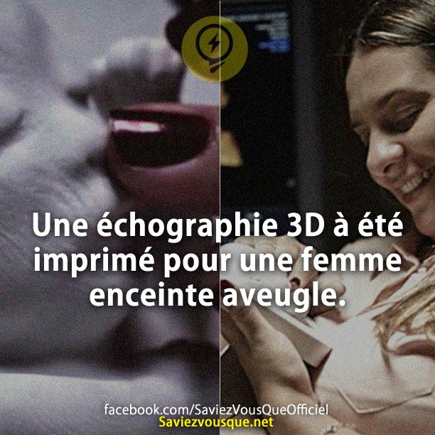 Une échographie 3D à été imprimé pour une femme enceinte aveugle.