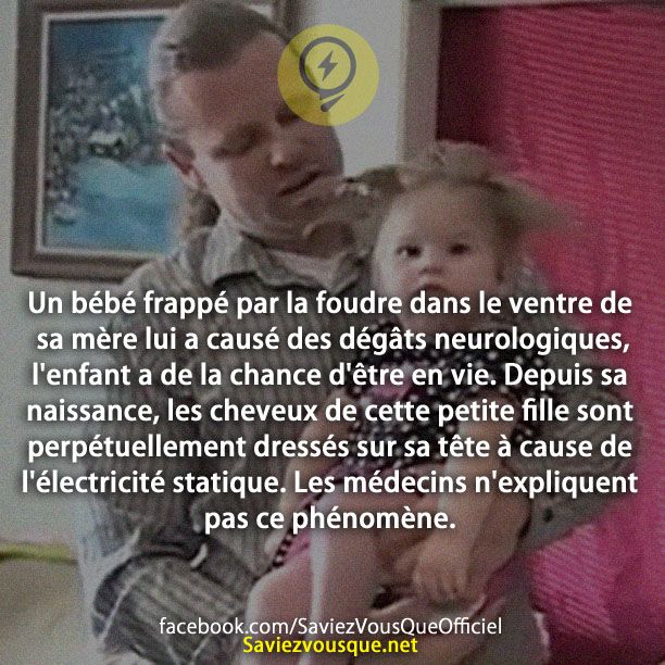 Un bébé frappé par la foudre dans le ventre de sa mère lui a causé des dégâts neurologiques, l&#039;enfant a de la chance d&#039;être en vie. Depuis sa naissance, les cheveux de cette petite fille sont perpétuellement dressés sur sa tête à cause de l&#039;électricité statique. Les médecins n&#039;expliquent pas ce phénomène.