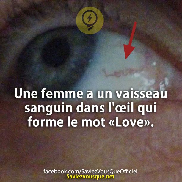 Une femme a un vaisseau sanguin dans l&#039;œil qui forme le mot «Love».
