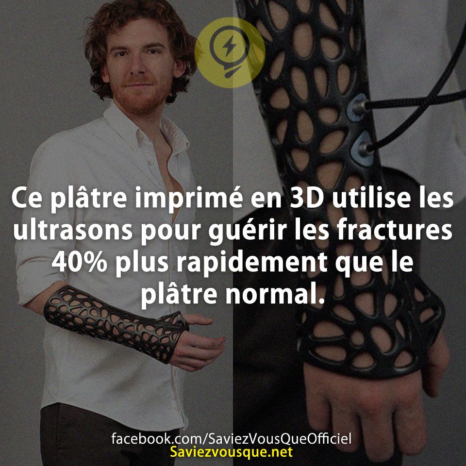 Ce plâtre imprimé en 3D utilise les ultrasons pour guérir les fractures 40% plus rapidement que le plâtre normal.