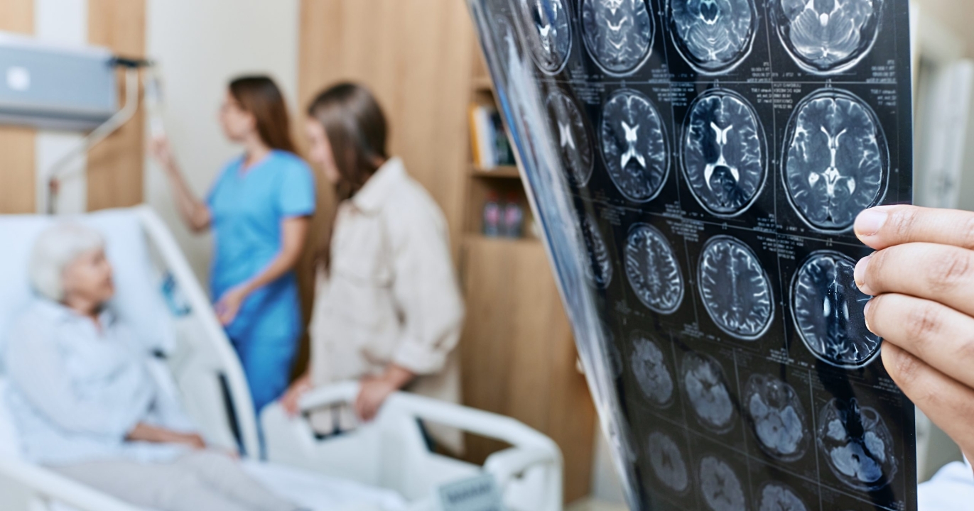 Les 5 Façons d'améliorer sa mémoire afin d'être moins sujet à l'Alzheimer