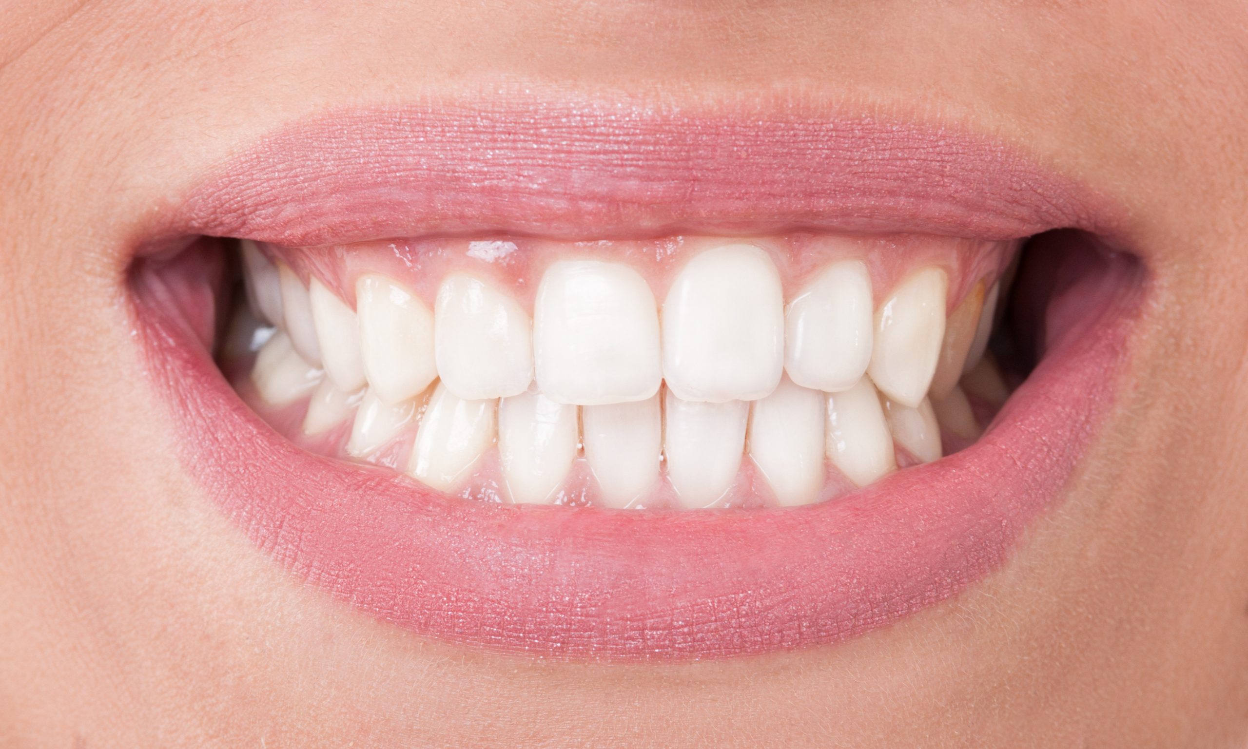 Les avantages d’une repousse naturelle des dents