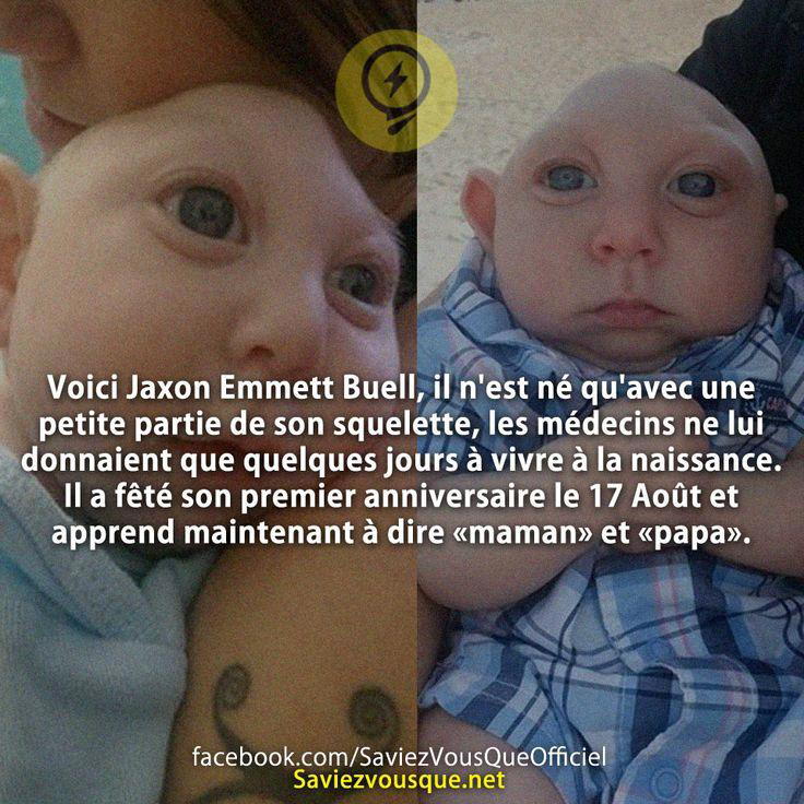 Voici Jaxon Emmett Buell, il n’est né qu’avec une petite partie de son squelette, les médecins ne lui donnaient que quelques jours à vivre à la naissance. Il a fêté son premier anniversaire le 17 Août et apprend maintenant à dire «maman» et «papa».